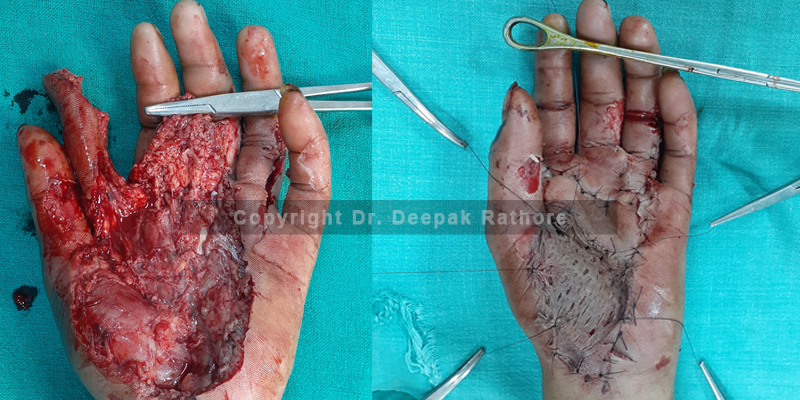 Plastic Surgeons in Noida